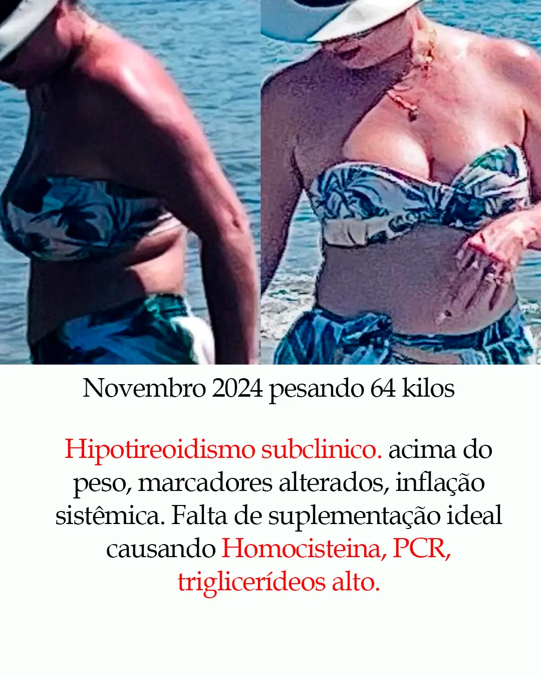 Wanda antes e depois